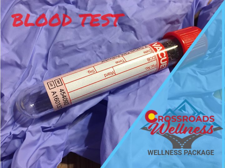 Blood Test screening with analysis 